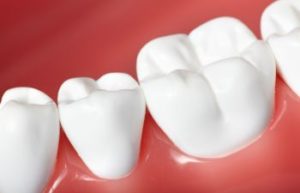 Atlanta GA Dentist That Treats Periodontitis