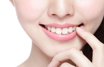 Closeup of Woman Smiling After Porcelain Veneers and Bonding